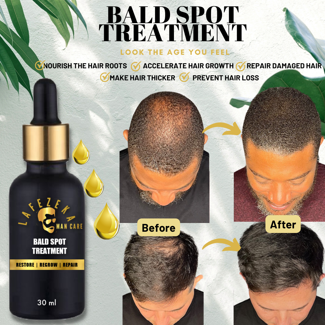 Bald Spot Hair Loss Roots Scalp Treatment Repair Oil